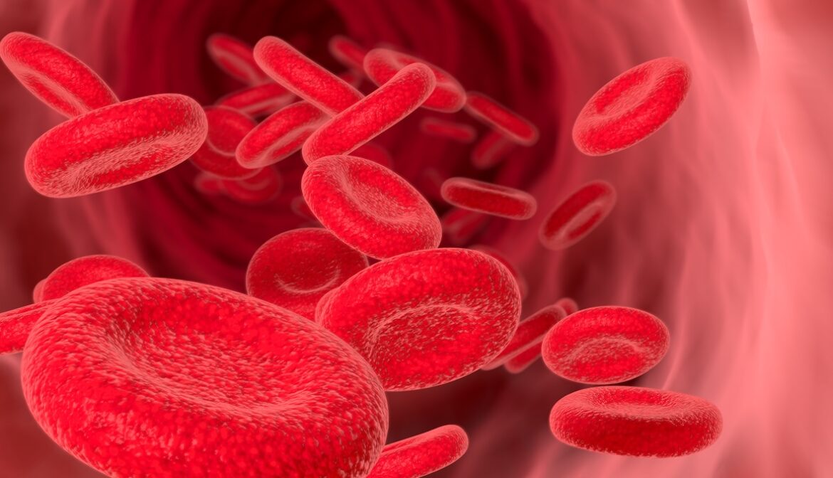 Doc - Hémochromatose